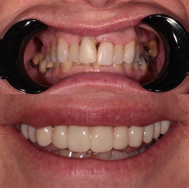 BA 0404