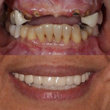 BA 0909